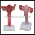Modelo de útero ISO, Anatomía del útero femenino ampliado HR-436A